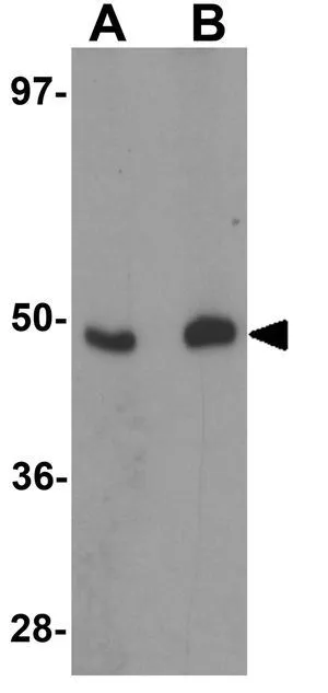 WB analysis of HeLa cell lysate using GTX31807 FOXO4 antibody. Working concentration : (A) 0.5 and (B) 1 microg/ml WB analysis of HeLa cell lysate using GTX31807 FOXO4 antibody. Working concentration : (A) 0.5 and (B) 1 microg/ml