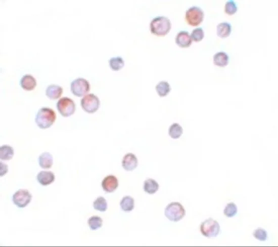 ICC/IF analysis of HeLa cells using GTX31807 FOXO4 antibody. Working concentration : 10 microg/ml