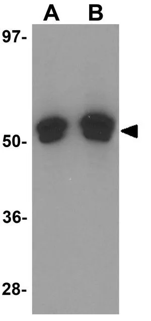 WB analysis of A-20 cell lysate using GTX31808 FOXO4 antibody. Working concentration : (A) 0.5 and (B) 1 microg/ml WB analysis of A-20 cell lysate using GTX31808 FOXO4 antibody. Working concentration : (A) 0.5 and (B) 1 microg/ml