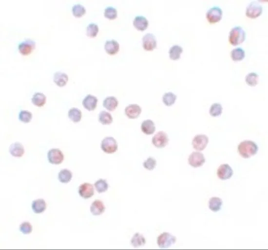 ICC/IF analysis of HeLa cells using GTX31808 FOXO4 antibody. Working concentration : 10 microg/ml