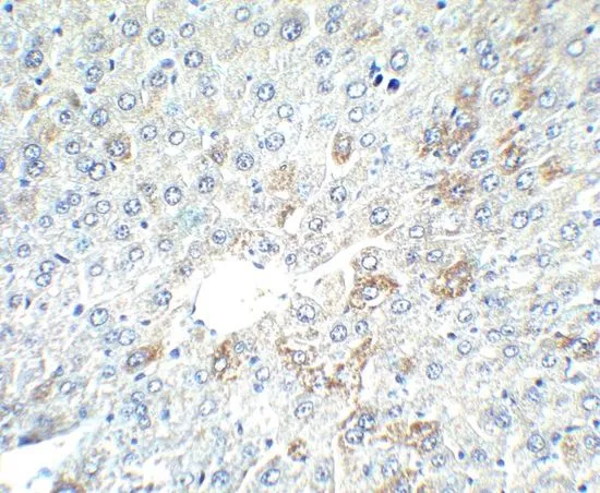 IHC-P analysis of mouse liver tissue using GTX31809 Alpha fetoprotein / AFP antibody. Working concentration : 2.5 microg/ml IHC-P analysis of mouse liver tissue using GTX31809 Alpha fetoprotein / AFP antibody. Working concentration : 2.5 microg/ml