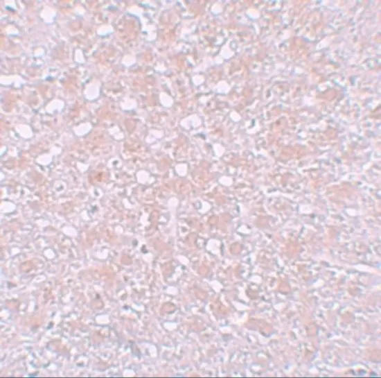 IHC-P analysis of rat liver tissue using GTX31809 Alpha fetoprotein / AFP antibody. Working concentration : 10 microg/ml