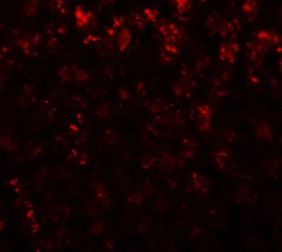 IHC-P analysis of rat liver tissue using GTX31809 Alpha fetoprotein / AFP antibody. Working concentration : 20 microg/ml