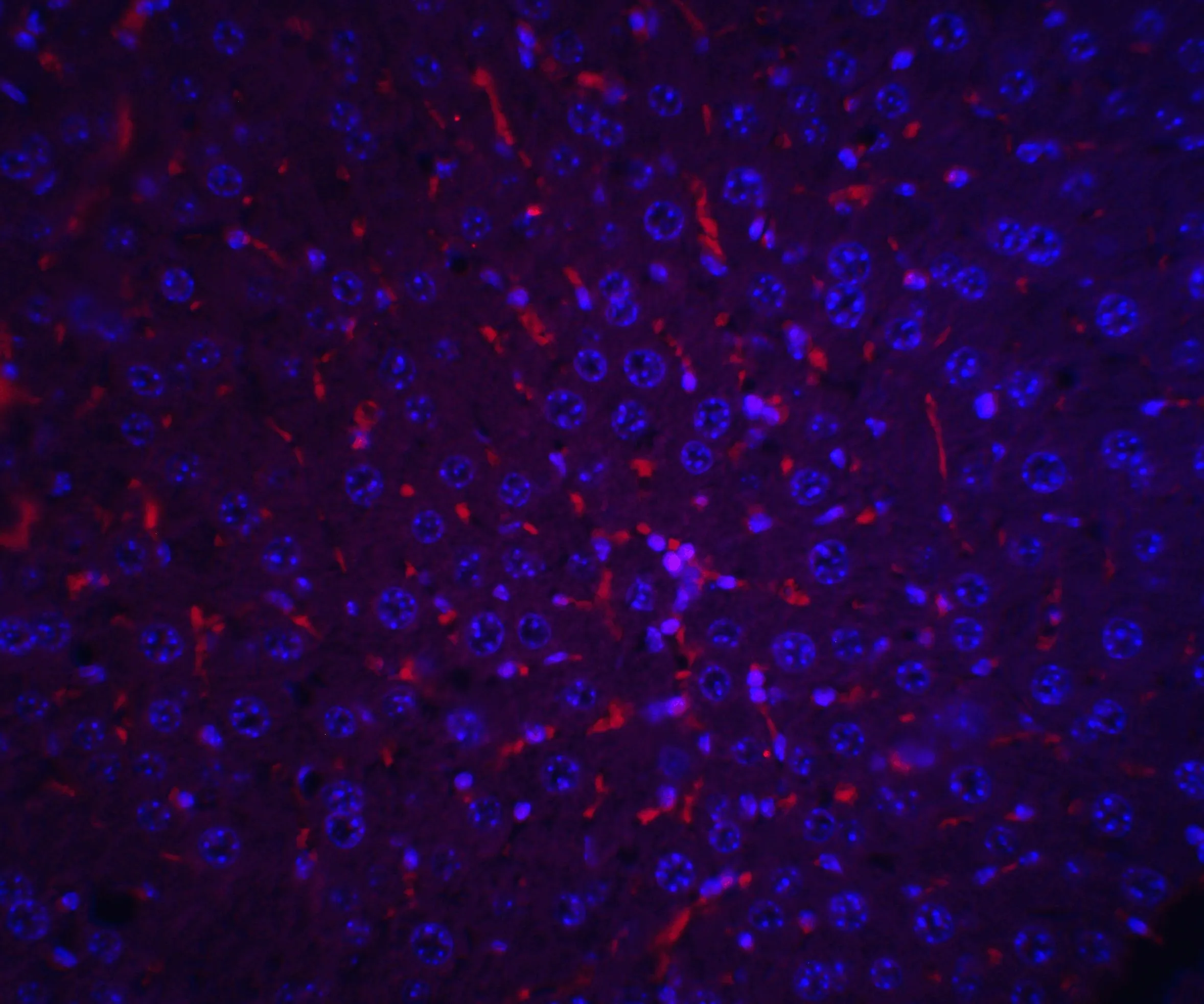 IHC-P analysis of mouse liver tissue using GTX31809 Alpha fetoprotein / AFP antibody. Red : Primary antibody Blue : DAPI Dilution : 20 microg/ml