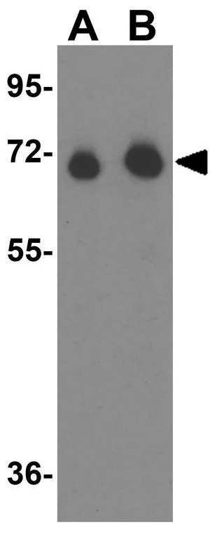 WB analysis of fetal human liver tissue lysate using GTX31809 Alpha fetoprotein / AFP antibody. Working concentration : (A) 1 and (B) 2 microg/ml