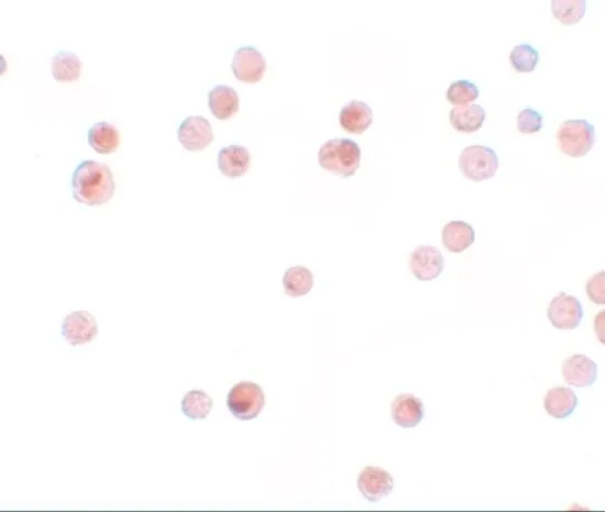 ICC/IF analysis of HeLa cells using GTX31813 KPNA4 antibody. Working concentration : 2.5 microg/ml