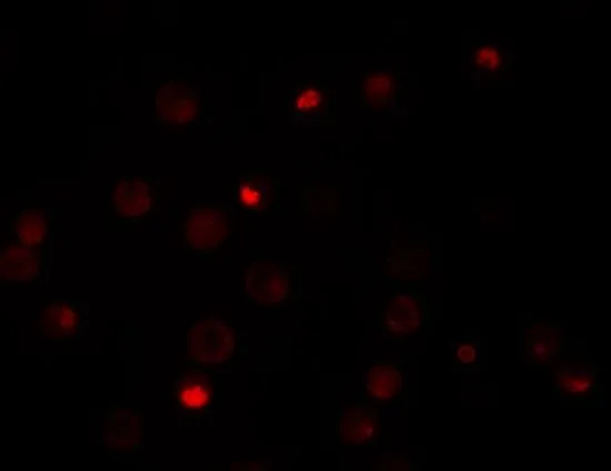 ICC/IF analysis of HeLa cells using GTX31813 KPNA4 antibody. Working concentration : 20 microg/ml