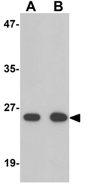 WB analysis of human kidney tissue lysate using GTX31814 ZNF346 antibody. Working concentration : (A) 0.5 and (B) 1 microg/ml WB analysis of human kidney tissue lysate using GTX31814 ZNF346 antibody. Working concentration : (A) 0.5 and (B) 1 microg/ml
