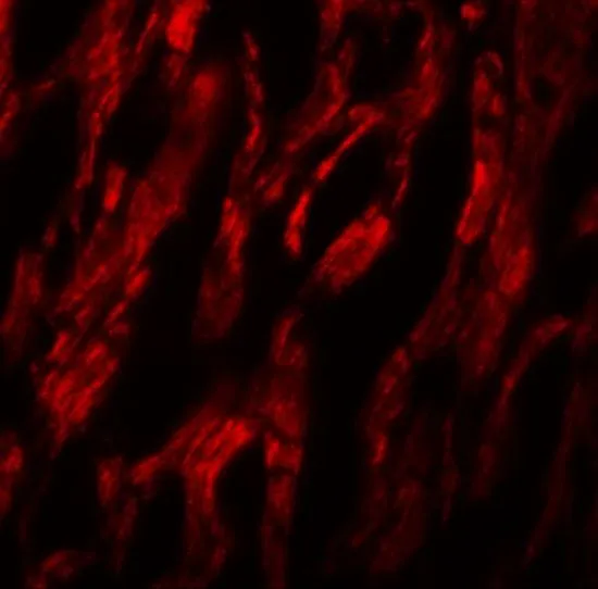IHC-P analysis of human heart tissue using GTX31815 ATG9A antibody. Working concentration : 20 microg/ml
