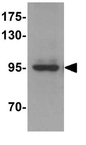 WB analysis of mouse heart tissue lysate using GTX31815 ATG9A antibody. Working concentration : 1 microg/ml