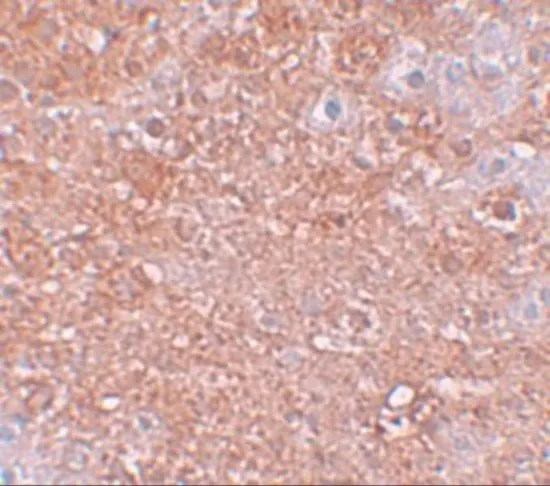 IHC-P analysis of mouse liver tissue using GTX31818 SLC39A12 antibody. Working concentration : 2.5 microg/ml IHC-P analysis of mouse liver tissue using GTX31818 SLC39A12 antibody. Working concentration : 2.5 microg/ml