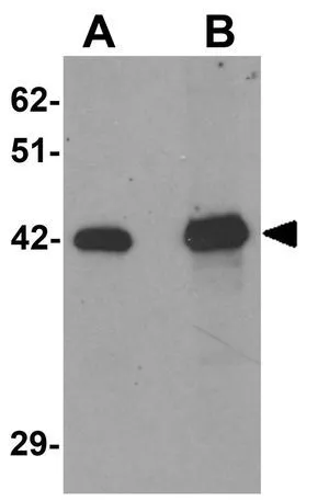 WB analysis of HepG2 cell lysate using GTX31818 SLC39A12 antibody. Working concentration : (A) 0.5 and (B) 1 microg/ml