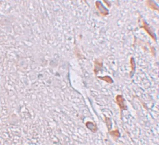 IHC-P analysis of human brain tissue using GTX31823 LRRTM1 antibody. Working concentration : 5 microg/ml IHC-P analysis of human brain tissue using GTX31823 LRRTM1 antibody. Working concentration : 5 microg/ml
