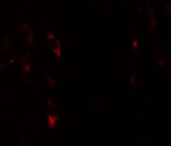 IHC-P analysis of human brain tissue using GTX31823 LRRTM1 antibody. Working concentration : 20 microg/ml