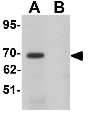 WB analysis of mouse brain tissue lysate in (A) the absence and (B) the presence of blocking peptide using GTX31823 LRRTM1 antibody. Working concentration : 1 microg/ml