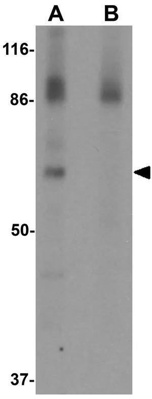 WB analysis of rat colon tissue lysate in (A) the absence and (B) the presence of blocking peptide using GTX31825 ESRP1 antibody. Working concentration : 0.5 microg/ml