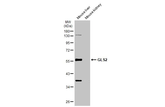 Various tissue extracts (50 microg) were separated by 10% SDS-PAGE, and the membrane was blotted with GLS2 antibody (GTX31828) diluted at 1:500. The HRP-conjugated anti-rabbit IgG antibody (GTX213110-01) was used to detect the primary antibody.