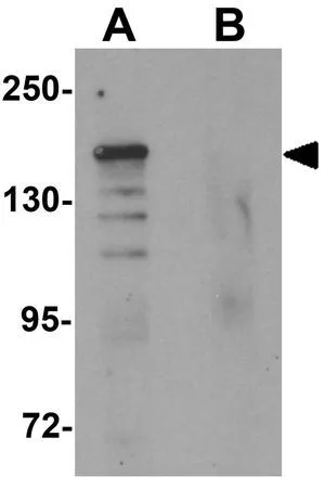 WB analysis of 293 cell lysate in (A) the absence and (B) the presence of blocking peptide using GTX31836 ROCK1 antibody. Working concentration : 1 microg/ml WB analysis of 293 cell lysate in (A) the absence and (B) the presence of blocking peptide using GTX31836 ROCK1 antibody. Working concentration : 1 microg/ml