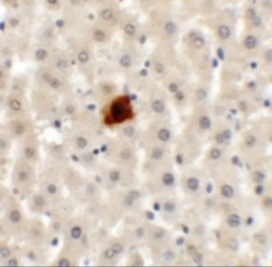 IHC-P analysis of rat liver tissue using GTX31841 EI24 antibody. Working concentration : 5 microg/ml IHC-P analysis of rat liver tissue using GTX31841 EI24 antibody. Working concentration : 5 microg/ml