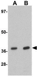 WB analysis of rat liver tissue lysate using GTX31841 EI24 antibody. Working concentration : (A) 1 and (B) 2 microg/ml