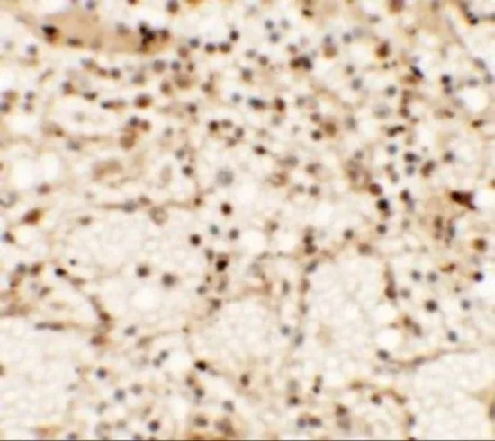 IHC-P analysis of human spleen tissue using GTX31853 Dectin-1 antibody. Working concentration : 5 microg/ml IHC-P analysis of human spleen tissue using GTX31853 Dectin-1 antibody. Working concentration : 5 microg/ml