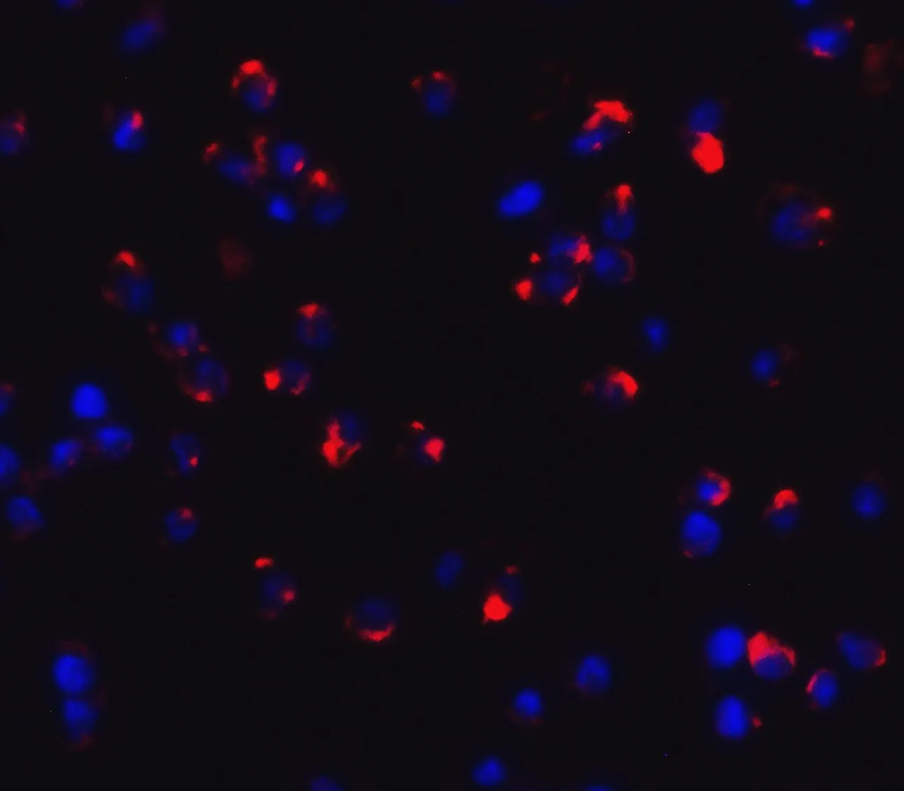 ICC/IF analysis of Jurkat cells using GTX31853 Dectin-1 antibody. Dilution : 20 microg/ml