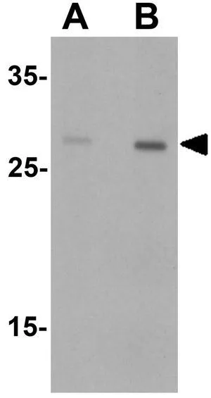 WB analysis of rat spleen tissue lysate using GTX31853 Dectin-1 antibody. Working concentration : (A) 1 and (B) 2 microg/ml