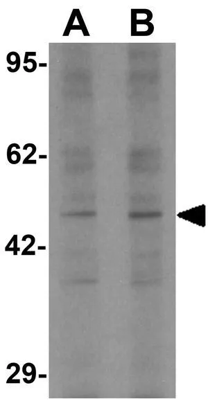 WB analysis of 293 cell lysate using GTX31857 LEMD2 antibody. Working concentration : (A) 1 and (B) 2 microg/ml WB analysis of 293 cell lysate using GTX31857 LEMD2 antibody. Working concentration : (A) 1 and (B) 2 microg/ml