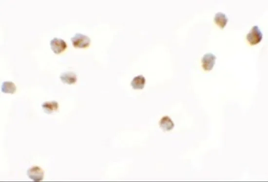 ICC/IF analysis of 3T3 cells using GTX31857 LEMD2 antibody. Working concentration : 2.5 microg/ml