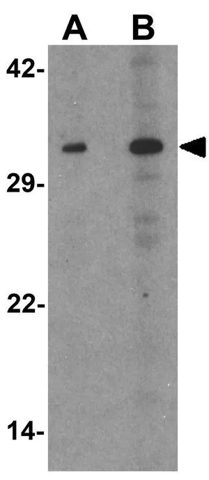 WB analysis of 293 cell lysate using GTX31859 p57 Kip2 antibody. Working concentration : (A) 1 and (B) 2 microg/ml WB analysis of 293 cell lysate using GTX31859 p57 Kip2 antibody. Working concentration : (A) 1 and (B) 2 microg/ml