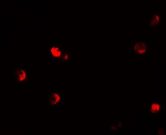 ICC/IF analysis of 293 cells using GTX31859 p57 Kip2 antibody. Working concentration : 20 microg/ml