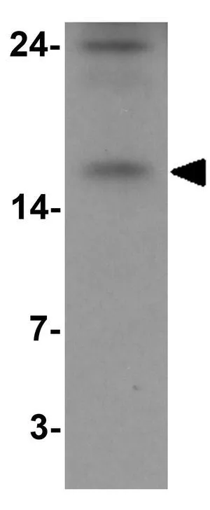IHC-P analysis of human spleen tissue using GTX31865 BATF antibody. Working concentration : 20 ug/ml