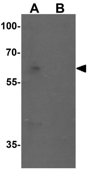 WB analysis of Jurkat cell lysate in (A) the absence and (B) the presence of blocking peptide using GTX31871 CARM1 antibody. Working concentration : 1 microg/ml WB analysis of Jurkat cell lysate in (A) the absence and (B) the presence of blocking peptide using GTX31871 CARM1 antibody. Working concentration : 1 microg/ml