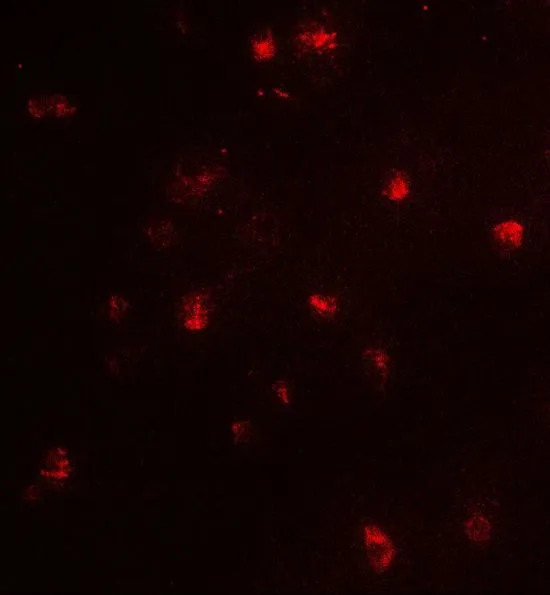 ICC/IF analysis of Jurkat cells using GTX31871 CARM1 antibody. Working concentration : 5 microg/ml