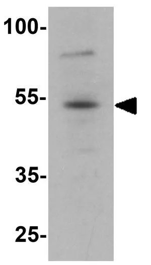 WB analysis of 293 cell lysate using GTX31874 FOXA1 antibody. Working concentration : 1 microg/ml WB analysis of 293 cell lysate using GTX31874 FOXA1 antibody. Working concentration : 1 microg/ml