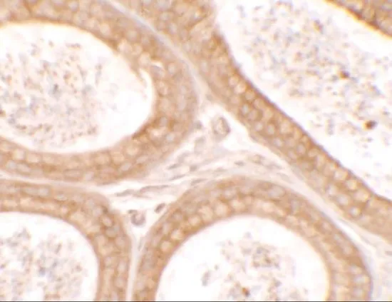 WB analysis of human ovary tissue lysate using GTX31880 DIS3 antibody. Working concentration : 1 ug/ml