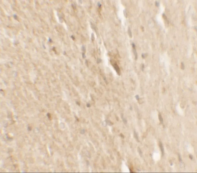 IHC-P analysis of formaldehyde fixed Human Small Intestine Tissue using GTX31881 B-Raf antibody. Antigen retreival : Heat mediation with a citrate buffer (pH6) Dilution : 2.5microg/mL IHC-P analysis of formaldehyde fixed Human Small Intestine Tissue using GTX31881 B-Raf antibody. Antigen retreival : Heat mediation with a citrate buffer (pH6) Dilution : 2.5microg/mL