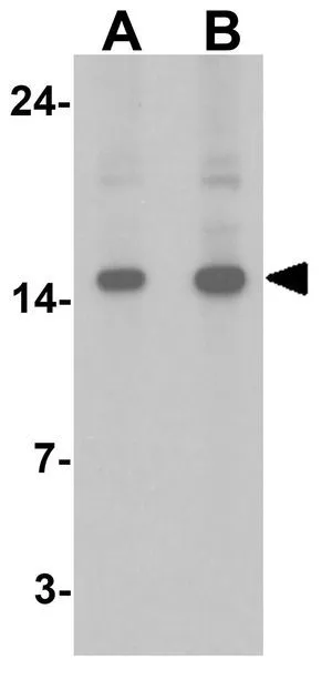 WB analysis of HeLa cell lysate using GTX31890 FHIT antibody. Working concentration : (A) 1 and (B) 2 microg/ml WB analysis of HeLa cell lysate using GTX31890 FHIT antibody. Working concentration : (A) 1 and (B) 2 microg/ml