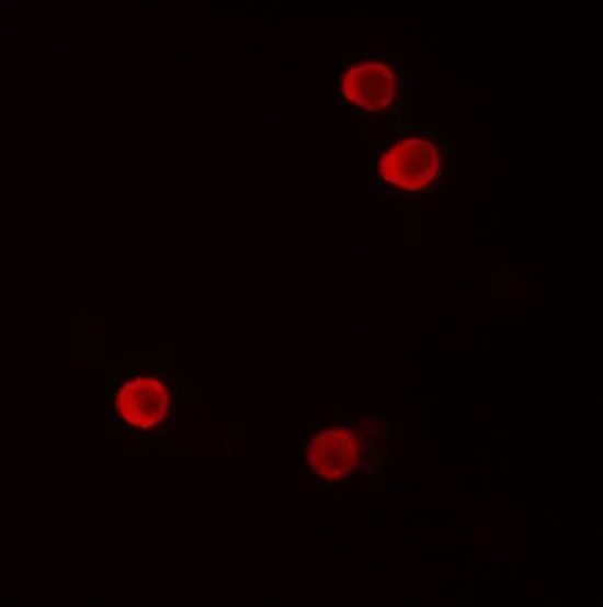 ICC/IF analysis of HeLa cells using GTX31890 FHIT antibody. Working concentration : 5 microg/ml