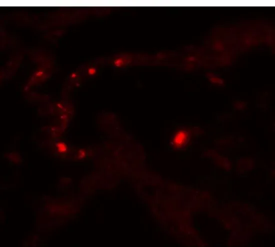 IHC-P analysis of human lung tissue using GTX31891 MMP9 antibody. Working concentration : 20 microg/ml