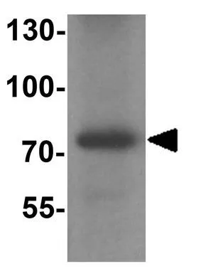 WB analysis of mouse lung tissue lysate using GTX31891 MMP9 antibody. Working concentration : 1 microg/ml