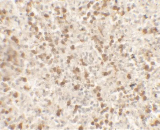 IHC-P analysis of human spleen tissue using GTX31894 IL9 antibody. Working concentration : 5 microg/ml IHC-P analysis of human spleen tissue using GTX31894 IL9 antibody. Working concentration : 5 microg/ml