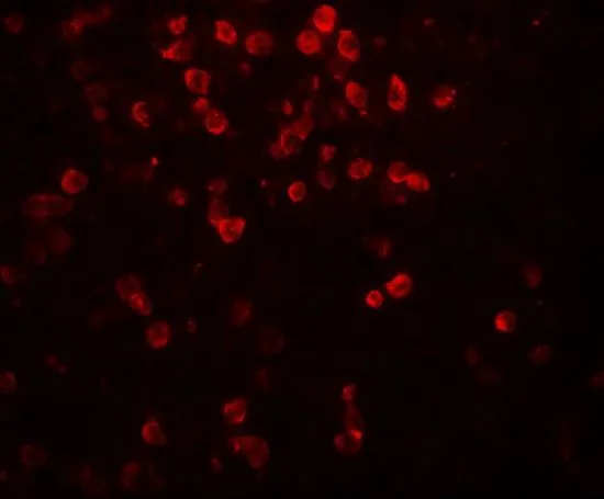 IHC-P analysis of human spleen tissue using GTX31894 IL9 antibody. Working concentration : 20 microg/ml