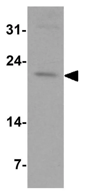 WB analysis of human spleen tissue lysate using GTX31894 IL9 antibody. Working concentration : 1 microg/ml