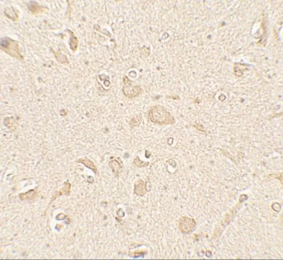 IHC-P analysis of human brain tissue using GTX31899 LC3B antibody. Working concentration : 5 microg/ml IHC-P analysis of human brain tissue using GTX31899 LC3B antibody. Working concentration : 5 microg/ml