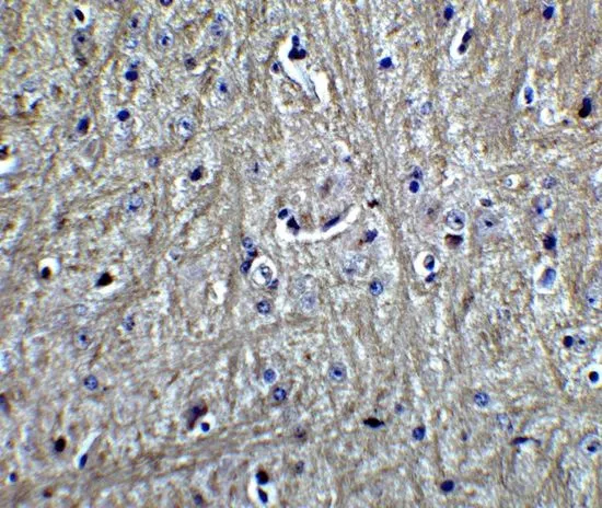 IHC-P analysis of mouse brain tissue using GTX31902 RPSA antibody. Working concentration : 5 microg/ml IHC-P analysis of mouse brain tissue using GTX31902 RPSA antibody. Working concentration : 5 microg/ml