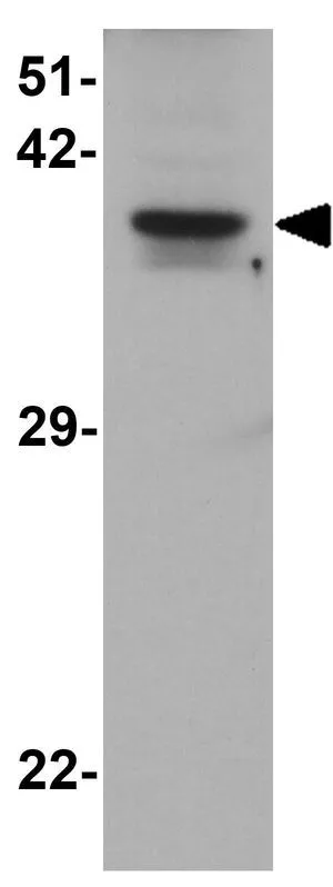 WB analysis of human brain tissue lysate using GTX31903 THAP11 antibody. Working concentration : 1 microg/ml WB analysis of human brain tissue lysate using GTX31903 THAP11 antibody. Working concentration : 1 microg/ml