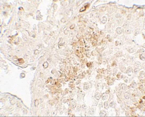 IHC-P analysis of human testis tissue using GTX31905 GLIPR1L1 antibody. Working concentration : 5 microg/ml IHC-P analysis of human testis tissue using GTX31905 GLIPR1L1 antibody. Working concentration : 5 microg/ml