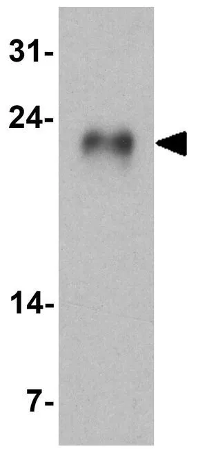 WB analysis of human testis tissue lysate using GTX31905 GLIPR1L1 antibody. Working concentration : 1 microg/ml