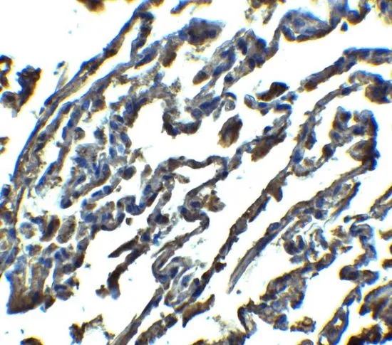 IHC-P analysis of human lung tissue using GTX31907 SPNS1 antibody. Working concentration : 2.5 microg/ml IHC-P analysis of human lung tissue using GTX31907 SPNS1 antibody. Working concentration : 2.5 microg/ml